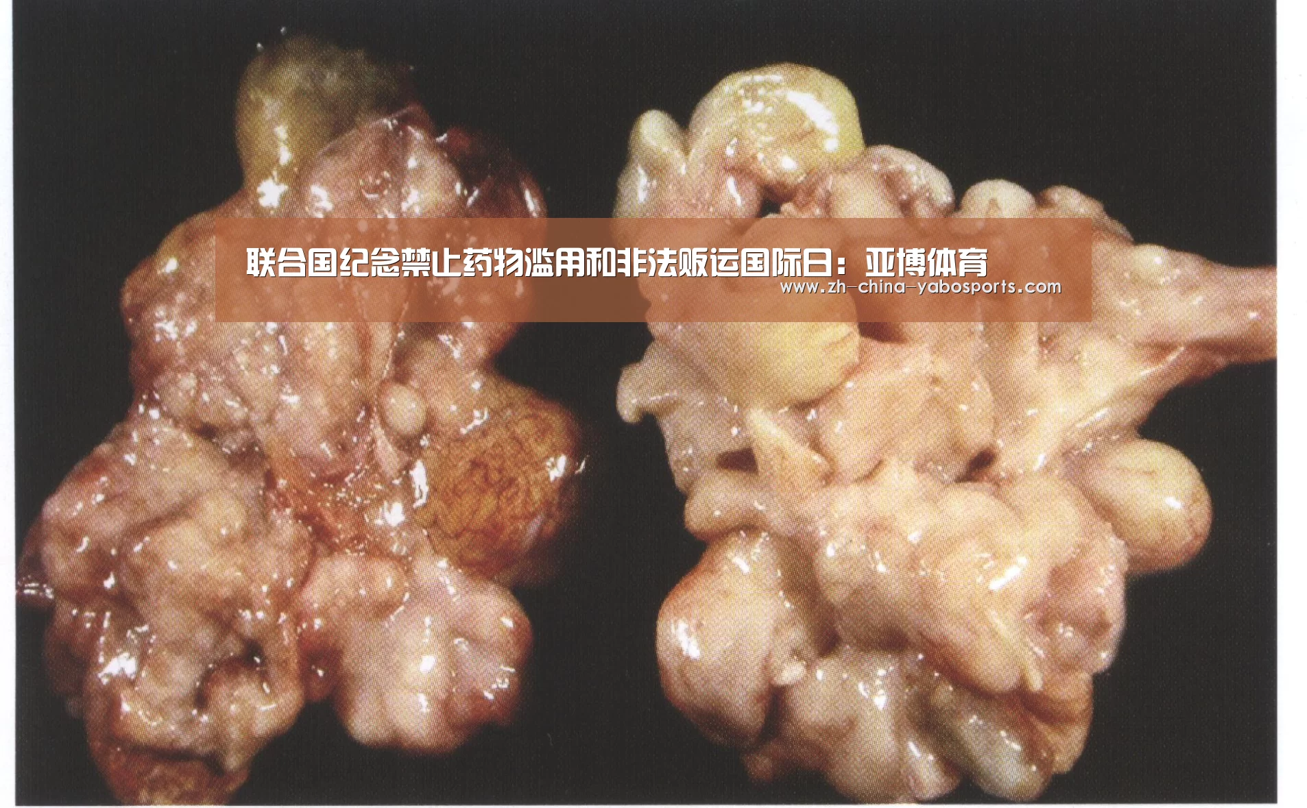 联合国纪念禁止药物滥用和非法贩运国际日:亚博体育(图2) Yabo亚博官方网站